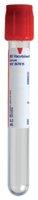 Red-topped serum tube