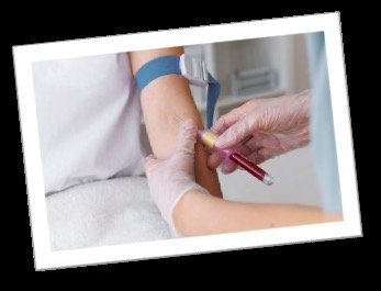 Blood test for screening