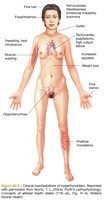 Pharmacologic agents for hyperthyroidism
