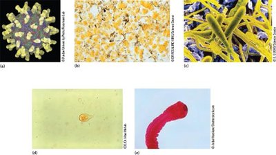 Major types of pathogens: virus, bacteria, fungus, protozoan, helminth