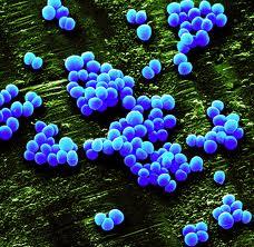 MRSA bacteria