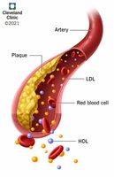 Cholesterol and lipoproteins in artery
