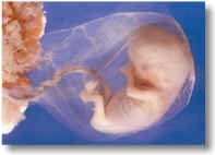 Human embryo in amniotic sac
