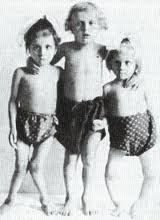 Scurvy symptoms poster