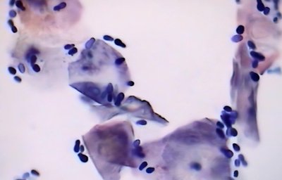 Microscopic view of dermatophyte arthrospores