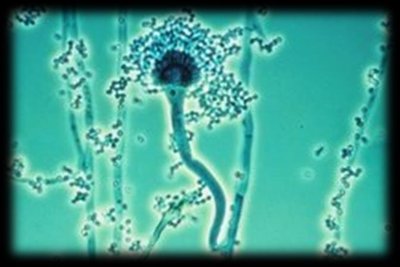 Microscopic view of Aspergillus species