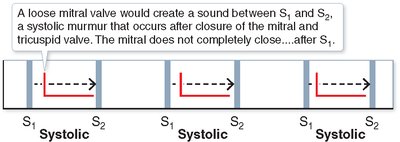 Mitral valve insufficiency murmur timing diagram
