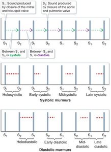 Timing of heart murmurs