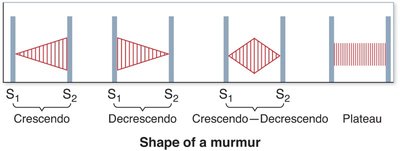 Shape of heart murmurs