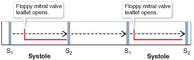 Mitral valve insufficiency murmur timing diagram