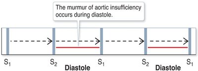 Aortic insufficiency murmur timing diagram