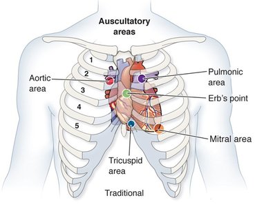 Auscultatory areas for heart valves on the chest