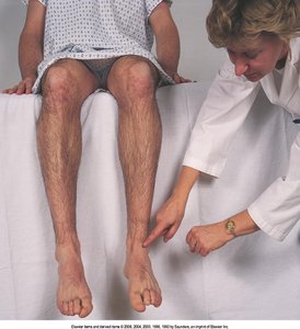 Assessment of color return in the foot