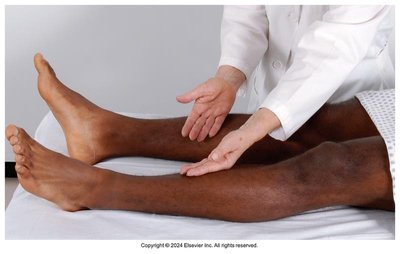 Peripheral vascular assessment flowsheet