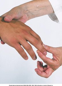 Palpation of finger joints