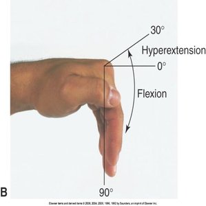 Hand hyperextension and flexion