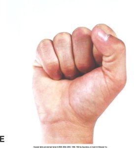 Hand making a fist