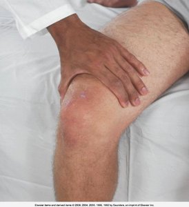 Palpation above knee joint