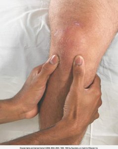 Palpation of tibiofemoral joint