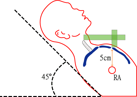 Jugular venous pulse assessment