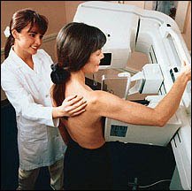 Breast screening procedure