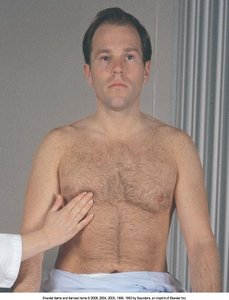 Male breast assessment