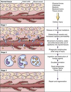 Stages of the inflammatory response after tissue injury