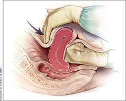 Caring for your baby in the first weeks after birth