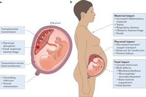 Maternal and fetal impacts of infection in pregnancy