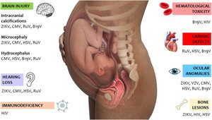 Fetal and maternal impacts of viral infections in pregnancy