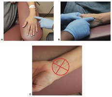 Anatomy of arm veins for venipuncture