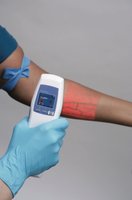 Vein visualization device