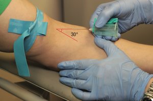 Venipuncture: correct needle angle