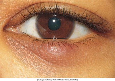 External eye anatomy