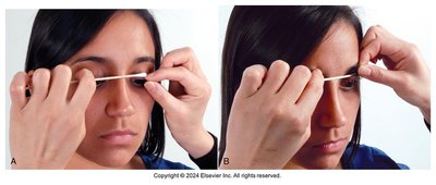 Anterior eye structures