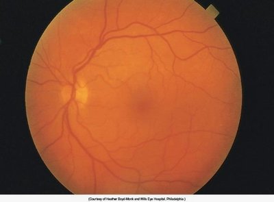 Normal ocular fundus