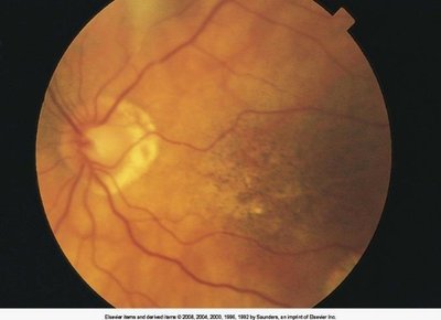 Ocular fundus with labeled structures