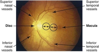 Infant visual assessment