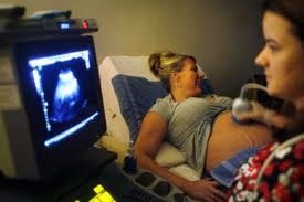 Pregnant woman undergoing ultrasound