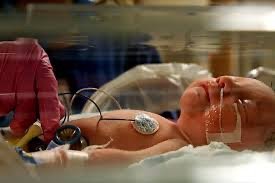 Preterm infant receiving medical care