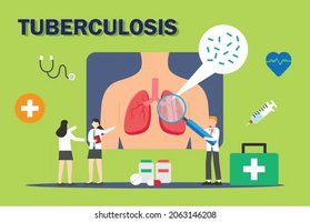 Tuberculosis overview illustration