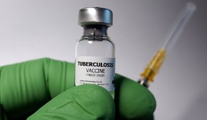 Tuberculosis vaccine vial