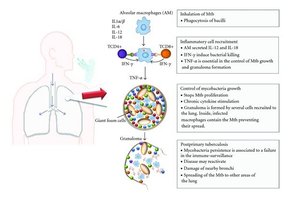 Pathophysiology of tuberculosis and immune response