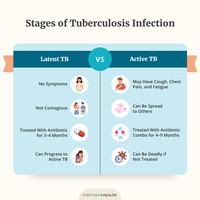Latent vs Active TB comparison