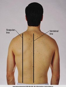 Posterior reference lines on the back