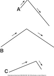 Palpation for symmetrical chest expansion, anterior