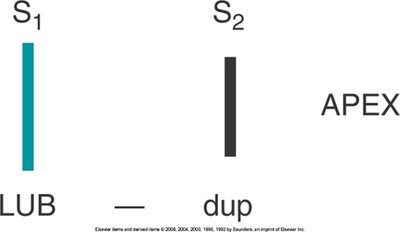 S1 heart sound at the apex