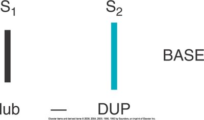 S2 heart sound at the base