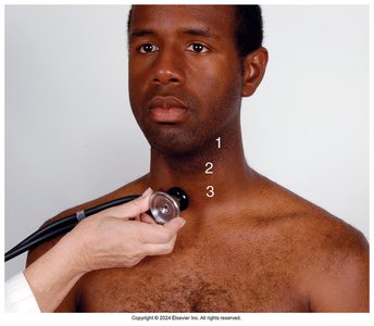 Auscultation of the carotid artery