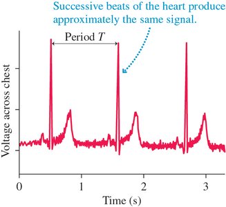 Graph showing period of heartbeats
